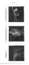 Fig. 05 - METHOD FOR SCREENING AN INHIBITORY AGENT OF HBV PROLIFERATION BY USING THE INTERACTION BETWEEN HBV CAPSID AND SURFACE PROTEINS BASED ON CELLULAR IMAGING
