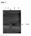 Fig. 02 - Method for enriching a prokaryotic DNA
