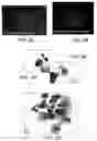 Fig. 04 - METHODS AND KITS FOR DIAGNOSING LUNG CANCER