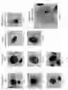 Fig. 08 - METHODS AND KITS FOR DIAGNOSING LUNG CANCER