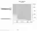 Fig. 08 - SCA RISK STRATIFICATION BY PREDICTING  PATIENT RESPONSE TO ANTI-ARRHYTHMICS