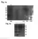 Fig. 02 - Spinocerebellar ataxia type 8 and methods of detection
