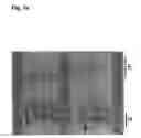 Fig. 04 - Spinocerebellar ataxia type 8 and methods of detection