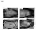 Fig. 07 - Granzyme A and granzyme B diagnostics