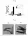 Fig. 03 - Proteins activating pro-phenoloxidase system and genes encoding the same