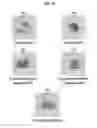 Fig. 12 - Proteins activating pro-phenoloxidase system and genes encoding the same