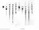 Fig. 02 - GLUCANOTRANSFERASE