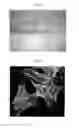 Fig. 02 - Injectable bone regeneration gel containing bone formation enhancing peptide