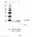Fig. 06 - PROCESS FOR THE PRODUCTION OF A PEPTIDE