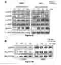 Fig. 06 - Methods and compositions for inducing deregulation of EPHA7 and ERK phosphorylation in human acute leukemias