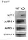 Fig. 07 - Methods of Treating a Microbial Infection by Modulating RNase-L Expression and/or Activity
