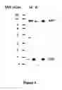 Fig. 05 - BACE455, AN ALTERNATIVE SPLICE VARIANT OF THE HUMAN BETA-SECRETASE