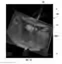 Fig. 05 - MRI-guided devices and MRI-guided interventional systems that can track and generate dynamic visualizations of the devices in near real time