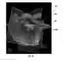 Fig. 06 - MRI-guided devices and MRI-guided interventional systems that can track and generate dynamic visualizations of the devices in near real time