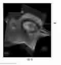 Fig. 07 - MRI-guided devices and MRI-guided interventional systems that can track and generate dynamic visualizations of the devices in near real time