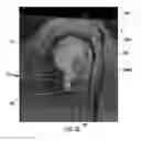 Fig. 08 - MRI-guided devices and MRI-guided interventional systems that can track and generate dynamic visualizations of the devices in near real time