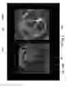 Fig. 09 - MRI-guided devices and MRI-guided interventional systems that can track and generate dynamic visualizations of the devices in near real time