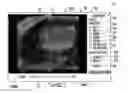 Fig. 10 - MRI-guided devices and MRI-guided interventional systems that can track and generate dynamic visualizations of the devices in near real time
