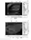 Fig. 11 - MRI-guided devices and MRI-guided interventional systems that can track and generate dynamic visualizations of the devices in near real time