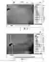 Fig. 12 - MRI-guided devices and MRI-guided interventional systems that can track and generate dynamic visualizations of the devices in near real time