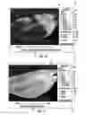 Fig. 16 - MRI-guided devices and MRI-guided interventional systems that can track and generate dynamic visualizations of the devices in near real time