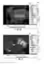 Fig. 17 - MRI-guided devices and MRI-guided interventional systems that can track and generate dynamic visualizations of the devices in near real time