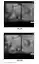 Fig. 19 - MRI-guided devices and MRI-guided interventional systems that can track and generate dynamic visualizations of the devices in near real time