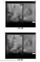 Fig. 20 - MRI-guided devices and MRI-guided interventional systems that can track and generate dynamic visualizations of the devices in near real time