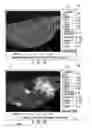 Fig. 22 - MRI-guided devices and MRI-guided interventional systems that can track and generate dynamic visualizations of the devices in near real time