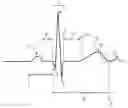 Fig. 01 - METHOD FOR QUANTITATIVE ASSESSMENT OF CARDIAC ELECTRICAL EVENTS
