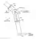 Fig. 01 - POWER REGENERATION IN ACTIVE MUSCLE ASSISTANCE DEVICE AND METHOD