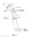 Fig. 02 - POWER REGENERATION IN ACTIVE MUSCLE ASSISTANCE DEVICE AND METHOD