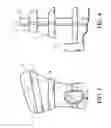 Fig. 03 - Therapeutic device that provides stimulation to an immobilized extremity