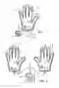 Fig. 05 - Therapeutic device that provides stimulation to an immobilized extremity