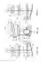 Fig. 10 - Therapeutic device that provides stimulation to an immobilized extremity