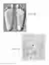 Fig. 14 - Therapeutic device that provides stimulation to an immobilized extremity