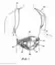 Fig. 02 - ADJUSTABLE POSTERIOR SPINAL ORTHOSIS
