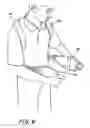 Fig. 07 - ADJUSTABLE POSTERIOR SPINAL ORTHOSIS