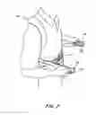 Fig. 08 - ADJUSTABLE POSTERIOR SPINAL ORTHOSIS