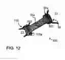 Fig. 22 - Devices, systems, and methods for achieving magnetic gastric bypass