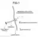 Fig. 02 - Medicinal-solution administration device
