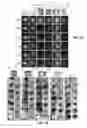 Fig. 08 - Nanosecond pulsed electric field parameters for destroying tumors with a single treatment
