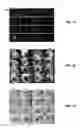 Fig. 12 - Nanosecond pulsed electric field parameters for destroying tumors with a single treatment