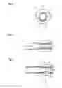 Fig. 03 - Guide tube having balloons for puncture