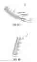 Fig. 09 - ANESTHESIA CONDUCTION CATHETER FOR DELIVERY OF ELECTRICAL STIMULUS