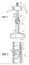 Fig. 02 - Obstetrical vacuum extractor with over-traction release
