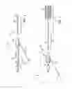 Fig. 02 - ACUTE STROKE REVASCULARIZATION/RECANALIZATION SYSTEMS PROCESSES AND PRODUCTS THEREBY
