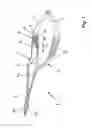 Fig. 02 - Surgical forceps for applying an aneurysm clip
