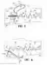 Fig. 04 - Subcutaneous sinusoidal wound closure utilizing one-way suture
