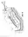 Fig. 06 - Subcutaneous sinusoidal wound closure utilizing one-way suture